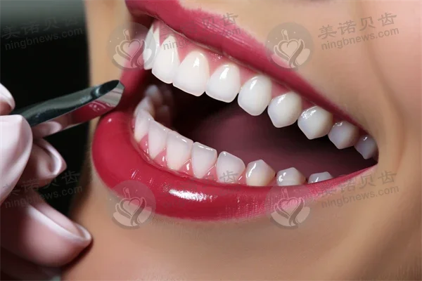 北京三十二贝口腔门诊部(天润店)牙齿美白价格表：原价1680元起，优惠价仅需1280元起！