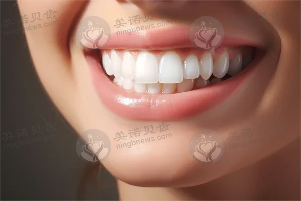 衡水可恩口腔医院联系方式及种植牙全攻略，了解种植牙价格与技术对比分析