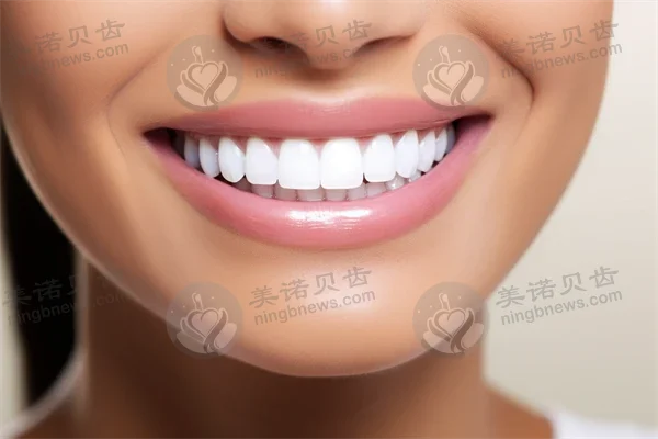 青岛市北卫雅仕口腔诊所超值烤瓷牙优惠活动，现仅需2500元起起，原价3000元起！