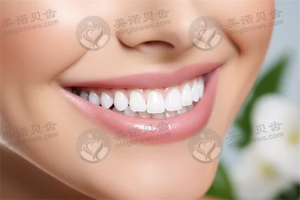 宁波海曙雅艺口腔门诊部推出牙套优惠活动，现仅需2999元起，原价3888元起，尽享超值折扣！