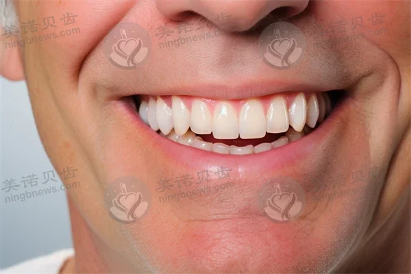 常熟明日口腔门诊部2026年价目表，儿童矫正与口腔护理服务全面解析