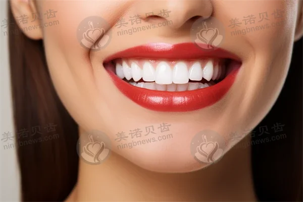 吉林张杰口腔医院隐形矫正技术优良，种植牙价格合理，2026年医院排名解析