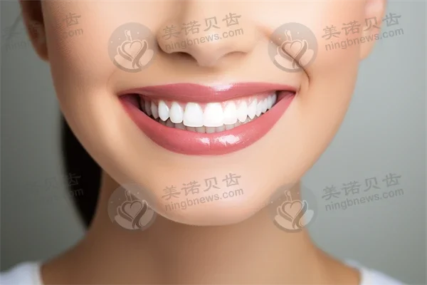 洗牙后是否可以正常进食？洗牙后的饮食注意事项是什么？