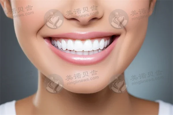 成都伊柔口腔诊所牙套价格仅需2880元起，原价3880元起，助您轻松拥有自信笑容！