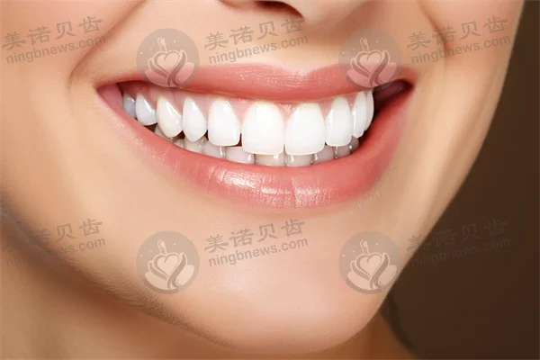 怀孕期间是否可以进行洗牙？孕妇洗牙的注意事项与建议
