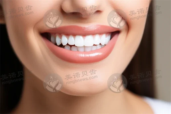 上海摩尔口腔医院（宝山院）推出牙齿矫正优惠活动，价格从9800元起降至7800元起，助力您轻松展现自信笑容！