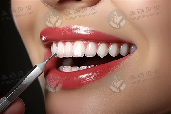 长沙好大夫口腔门诊部种植牙体验分享，真实评价与交通指南一览，助您轻松就医！