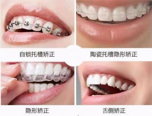 劲松口腔一般建议去吗?当然,劲松口腔的口碑和评价高|正规连锁就诊便利|质量过关