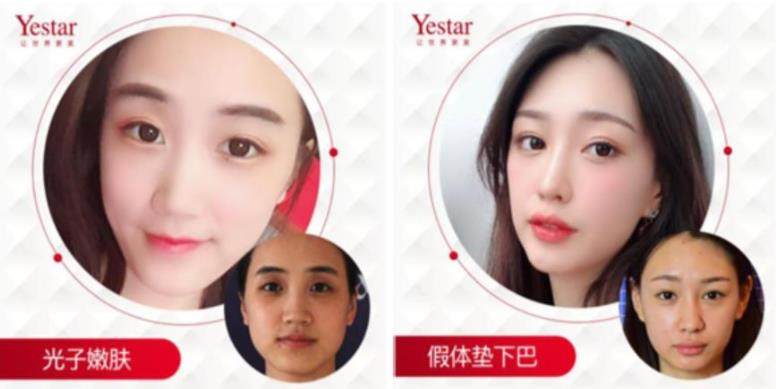 深圳艺星医疗美容医院口腔项目收费总结