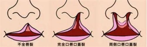 辽宁沈阳德立联合口腔医院公交怎么坐？看这篇攻略，轻松找到乘车路线！ 