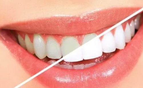 南京美奥口腔牙齿矫正项目价格