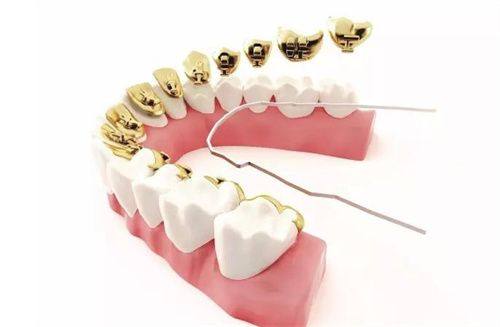 安徽马鞍山鼎植口腔价格表来啦!涵盖多种项目,价格合理让你看牙无负担