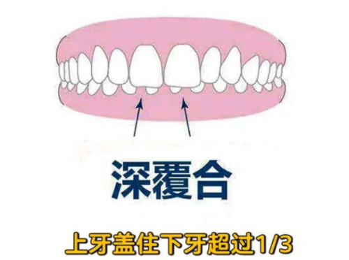 北京极简海德堡口腔坑不坑?真实体验揭秘,这家口腔机构服务和技术到底值不值!