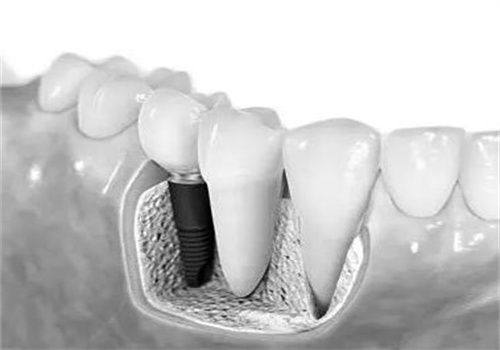 北京劲松口腔医院方庄店靠谱性分析