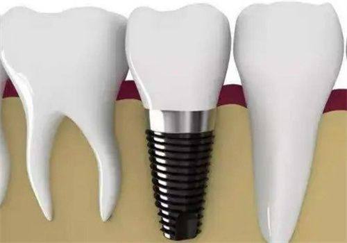 天津市中诺口腔患者口碑:技术靠谱,服务贴心