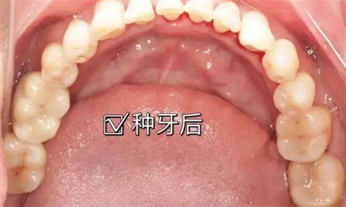 长沙美奥口腔医院:正规连锁,实力有保护