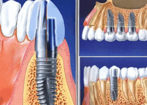总结：南京美奥口腔医院值得信赖