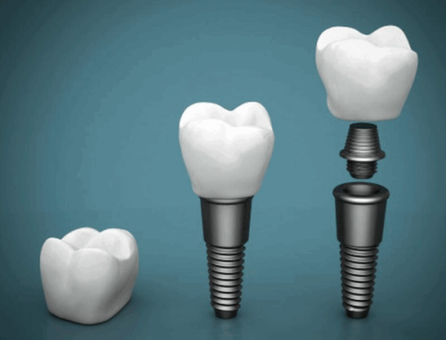 南京美奥口腔的服务与收费情况