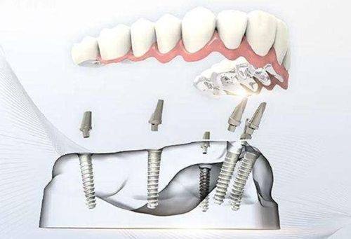 南京美奥口腔的技术特色