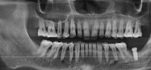 北京劲松口腔(方庄店)就诊体验,全方面优质服务