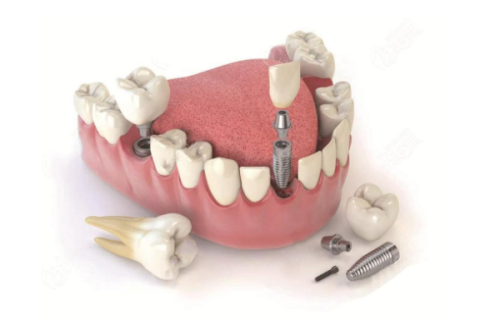 北京劲松口腔医院方庄店的服务与性价比