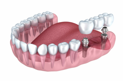 常州北极星口腔医院的收费情况