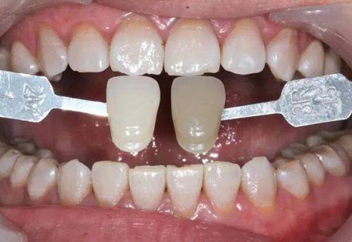 重庆团圆口腔医院的看牙收费