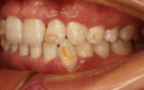 广州广大口腔医院：正规靠谱，值得选择