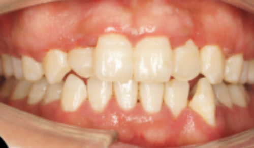 南京美奥口腔与其他眼科机构对比及性价比分析