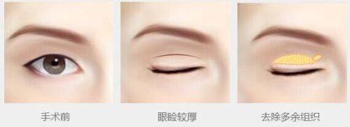 重庆牙博士口腔医院是莆田系医院吗?答案揭晓,它非莆田系且正规靠谱技术优