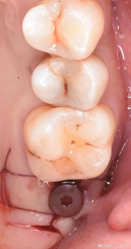 西宁小白兔口腔诊所牙齿矫正项目价格