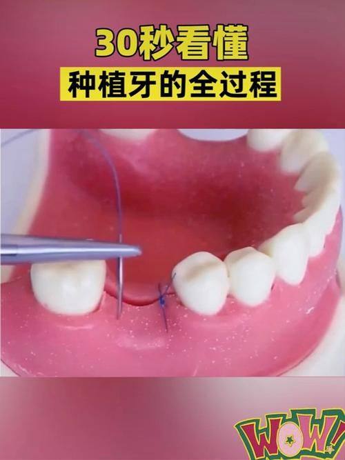 西宁小白兔口腔诊所儿童齿科收费情况