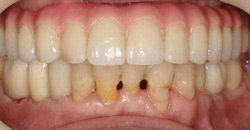 深圳正规口腔医院是哪些？十大靠谱牙科医院排行榜曝光 