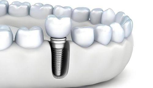 深圳正夫口腔(宝安总院)设备与技术