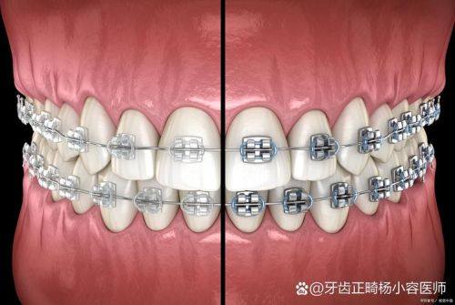 徐州瑞博医院口腔科价格表详情