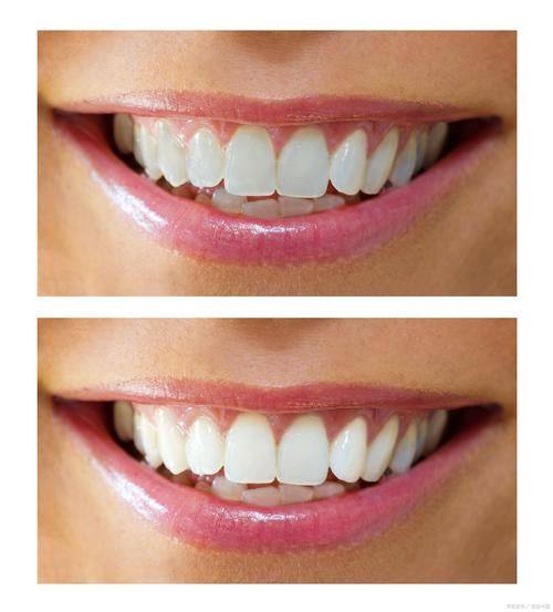 徐州瑞博医院口腔科:患者评价与成功范例