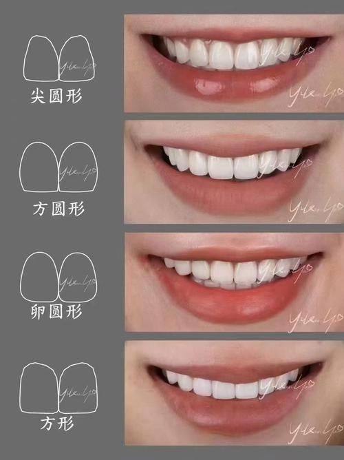 徐州瑞博医院口腔科坑不坑?实际体验揭秘,正规靠谱技术好服务优值得选