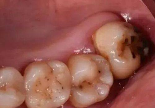 牡丹江中诺口腔医院:“便宜好技术”的典范