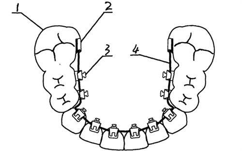 郑州植得口腔医院收费贵吗?看过来人真实评价,性价比高低一看便知!