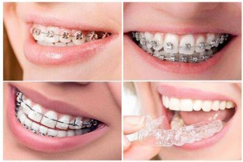 杭州美奥口腔医院的其他优势