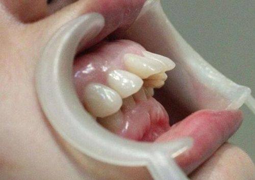 杭州美奥口腔医院 2025 收费价目表