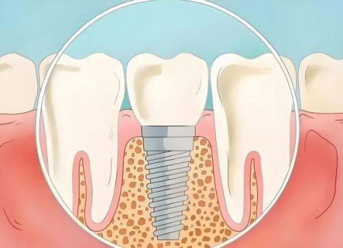 北京中诺口腔医院是正规的 3 级私立医院,实力强口碑好