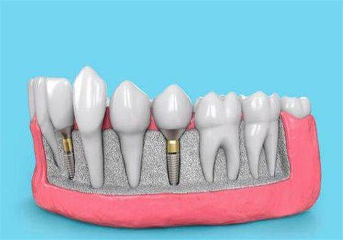 洛阳中诺口腔日常看牙与儿童项目:低价不低质