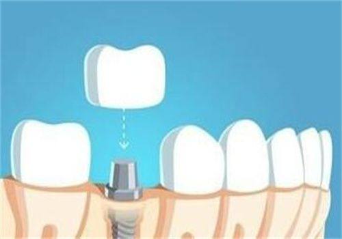 北京中诺口腔医院简介+地址电话+收费价格表+种植医生介绍