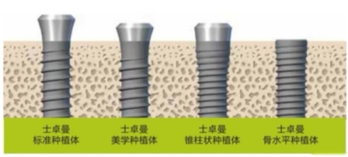 杭州美奥口腔医院是不是正规医院?答案是肯定的,它资质齐全、医生技术好值得信赖