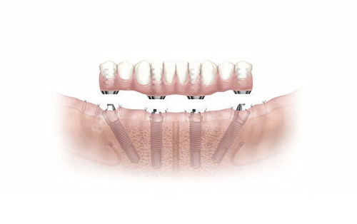 中诺口腔服务模式创新:把“面子工程”变成实在活动