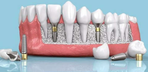 洛阳中诺口腔收费价目表大揭秘!各项口腔项目收费合理,让你看牙心中有数