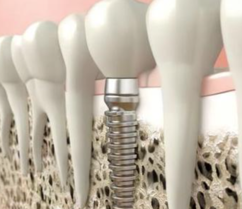 广州柏德口腔医院急诊服务及可靠性分析