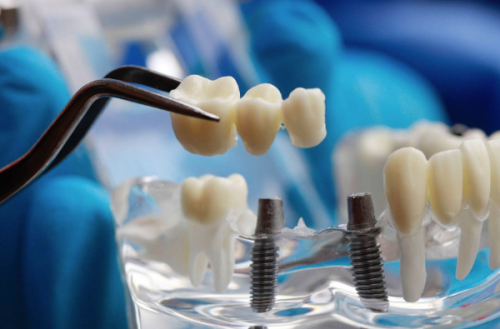 天津中幸口腔医院的合理收费性价比高