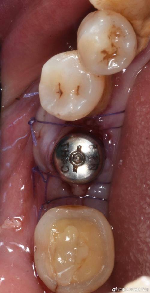 技术特色:中诺口腔医院VS劲松口腔医院